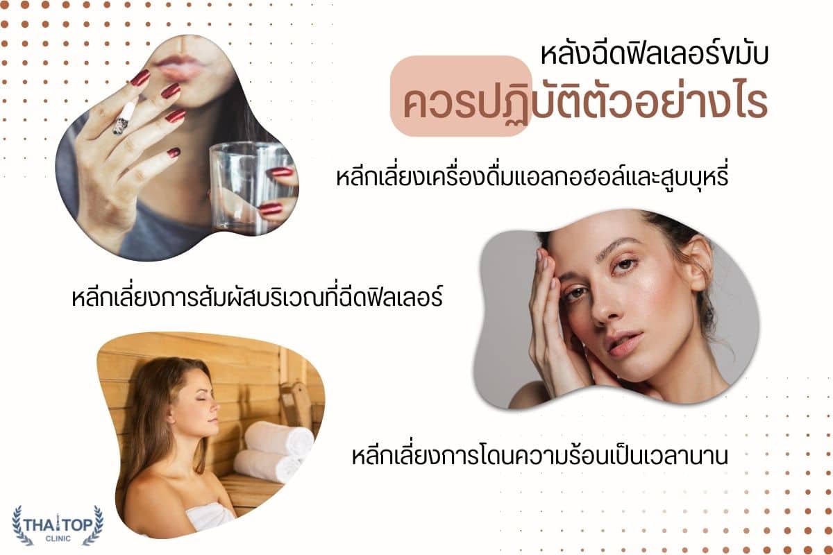 ฟิลเลอร์ขมับ restylane